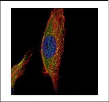 UNC13B antibody