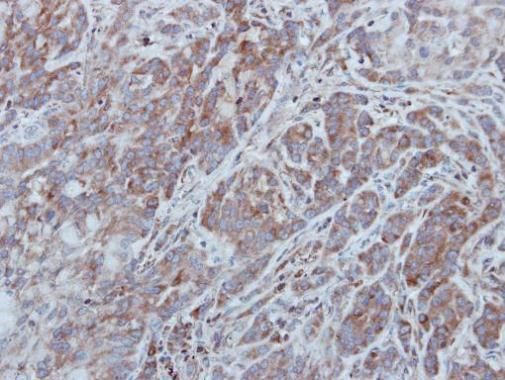 UNC13B antibody [N3C1], Internal