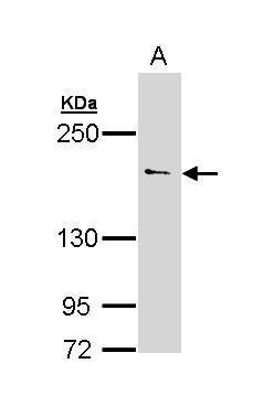 UNC13B antibody