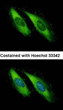 UNC13D antibody