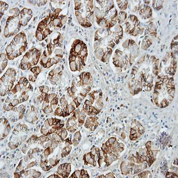 UNC13D antibody