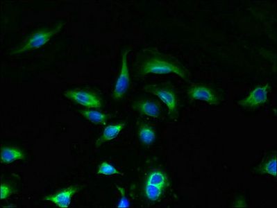 UNC50 antibody