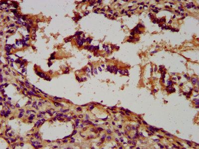 UNC5B Antibody