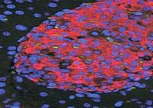 Goat anti-UNC5C Antibody