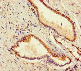 Adck2 Antibody