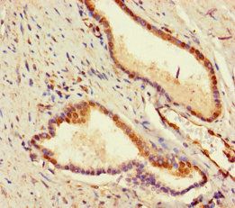 Uncharacterized aarF domain-containing protein kinase 2 antibody