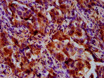 UPF3B Antibody