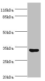 Upstream stimulatory factor 1 antibody