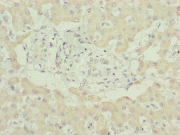 UQCC2 Antibody