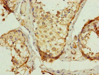 UQCRC2 Antibody