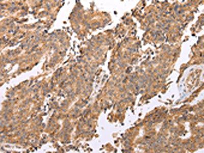 UQCRC2 Antibody