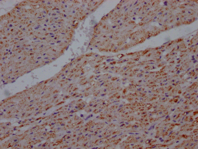 UQCRC2 Recombinant Monoclonal Antibody