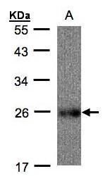 UQCRFS1 antibody