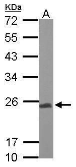 UQCRFS1 antibody