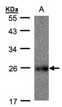 ubiquinol-cytochrome c reductase Rieske iron-sulfur polypeptide 1 antibody