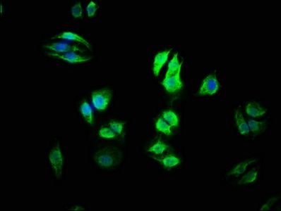 URI1 antibody