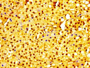 URI1 Antibody