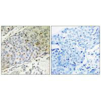 URI1 Antibody