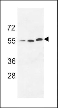 URKL1 antibody