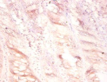 PLAU Antibody