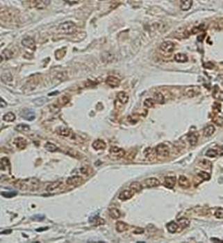 USF1 Rabbit Polyclonal Antibody