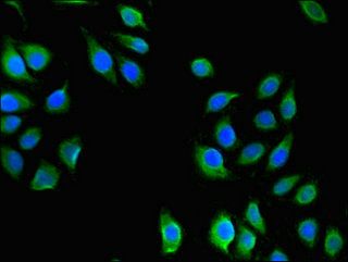 USHBP1 antibody