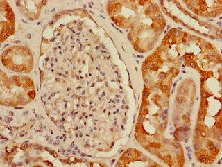 USHBP1 Antibody