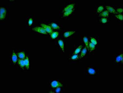 USO1 Antibody