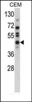 USP12 antibody