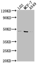 USP17L6P Antibody