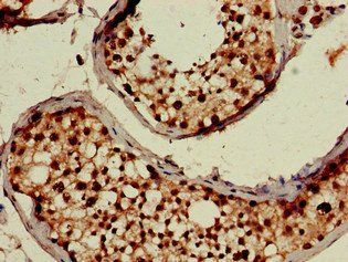 USP18 Antibody
