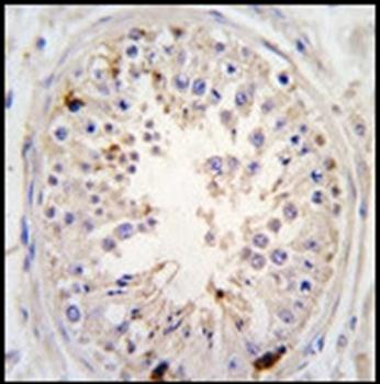 USP2 antibody