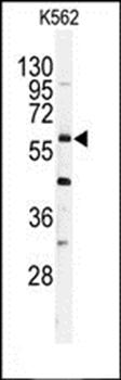 USP2 antibody