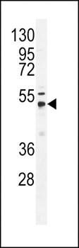 USP21 antibody