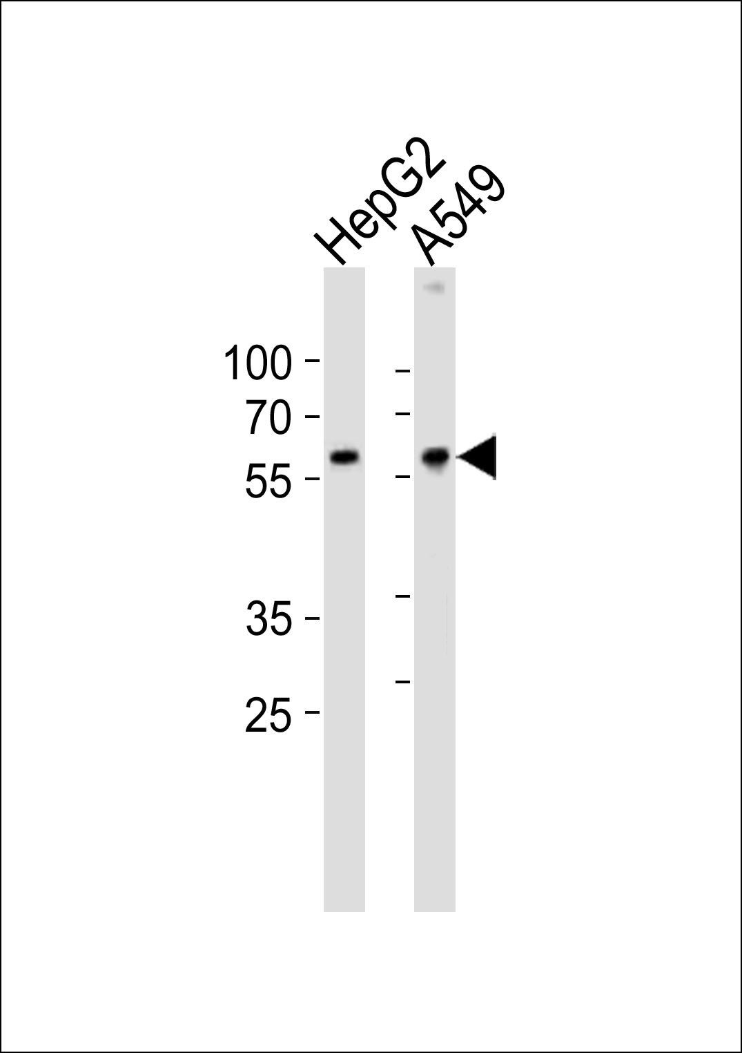 USP22 antibody