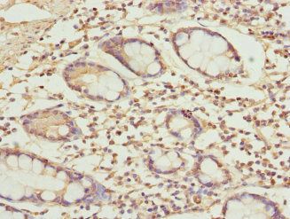 USP26 Antibody