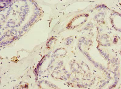 USP30 antibody