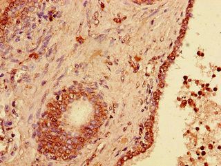 USP33 Antibody