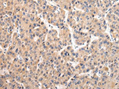 USP47 antibody