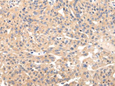 USP47 Antibody