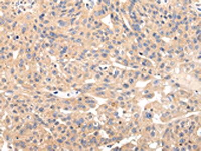 USP47 antibody