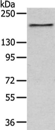 USP47 antibody