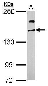 ubiquitin specific peptidase 47 Antibody