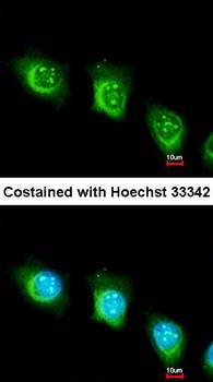 USP47 Rabbit Polyclonal Antibody