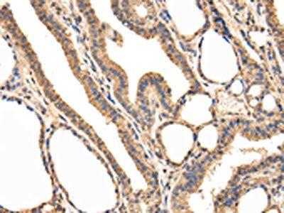 USP5 Antibody