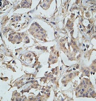 USP53 Rabbit Polyclonal Antibody