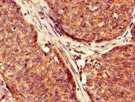 USP6 Antibody