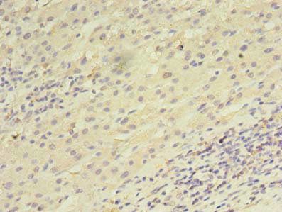 UTP23 Antibody