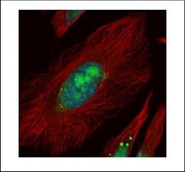 UTP6 Rabbit Polyclonal Antibody