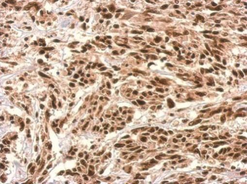 UTP6 Rabbit Polyclonal Antibody